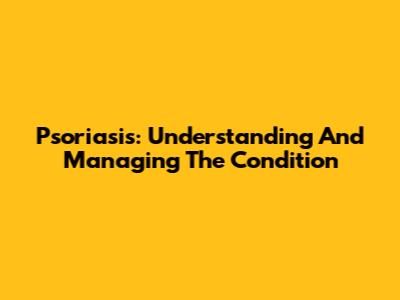 Psoriasis: Understanding And Managing The Condition